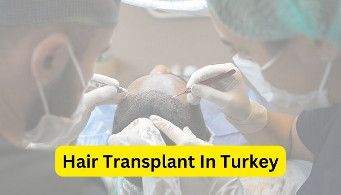 Cosmetic Tourism Hair Transplant In Turkey